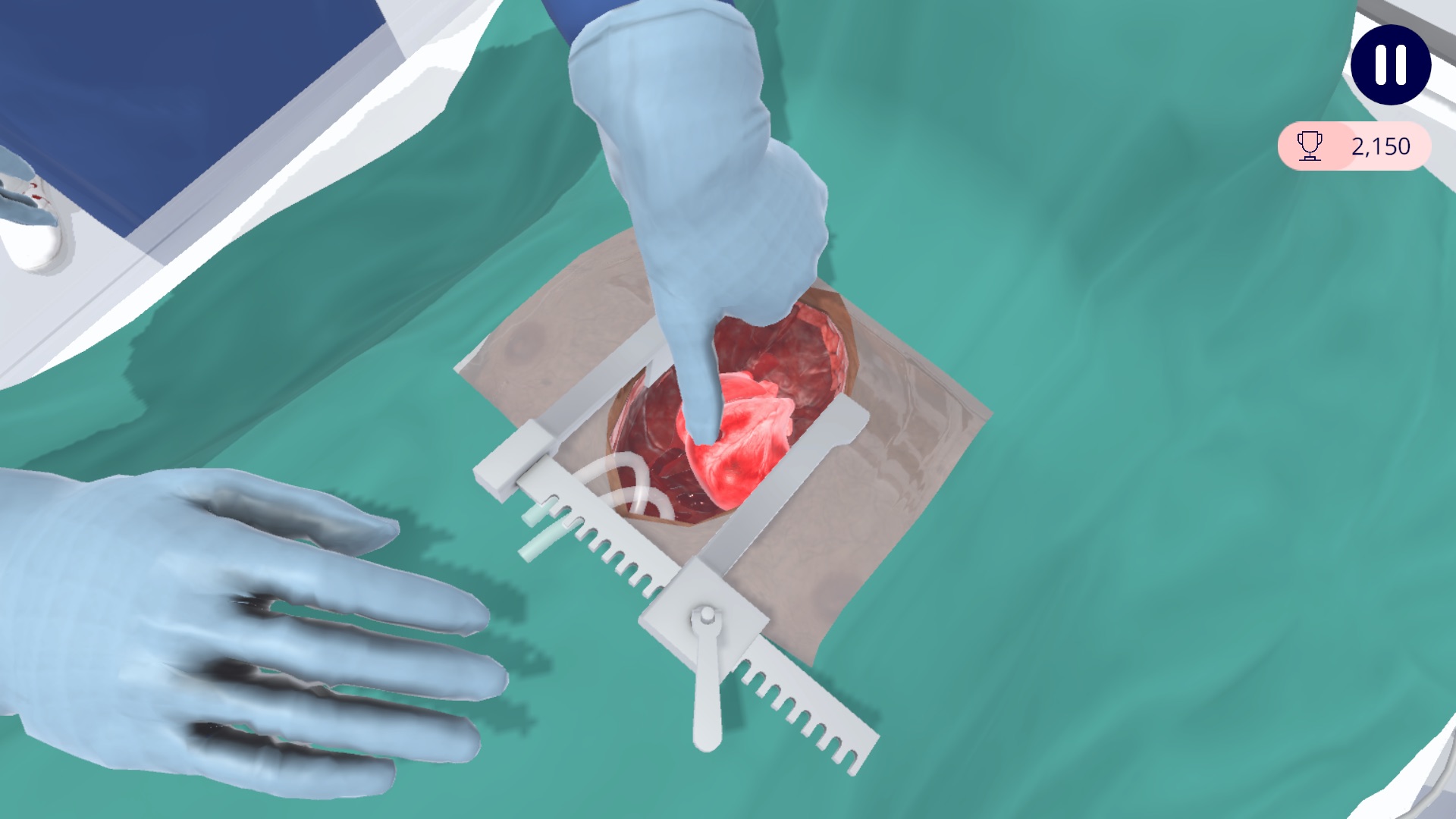 Surgical scenario: a beating heart during a CALS case